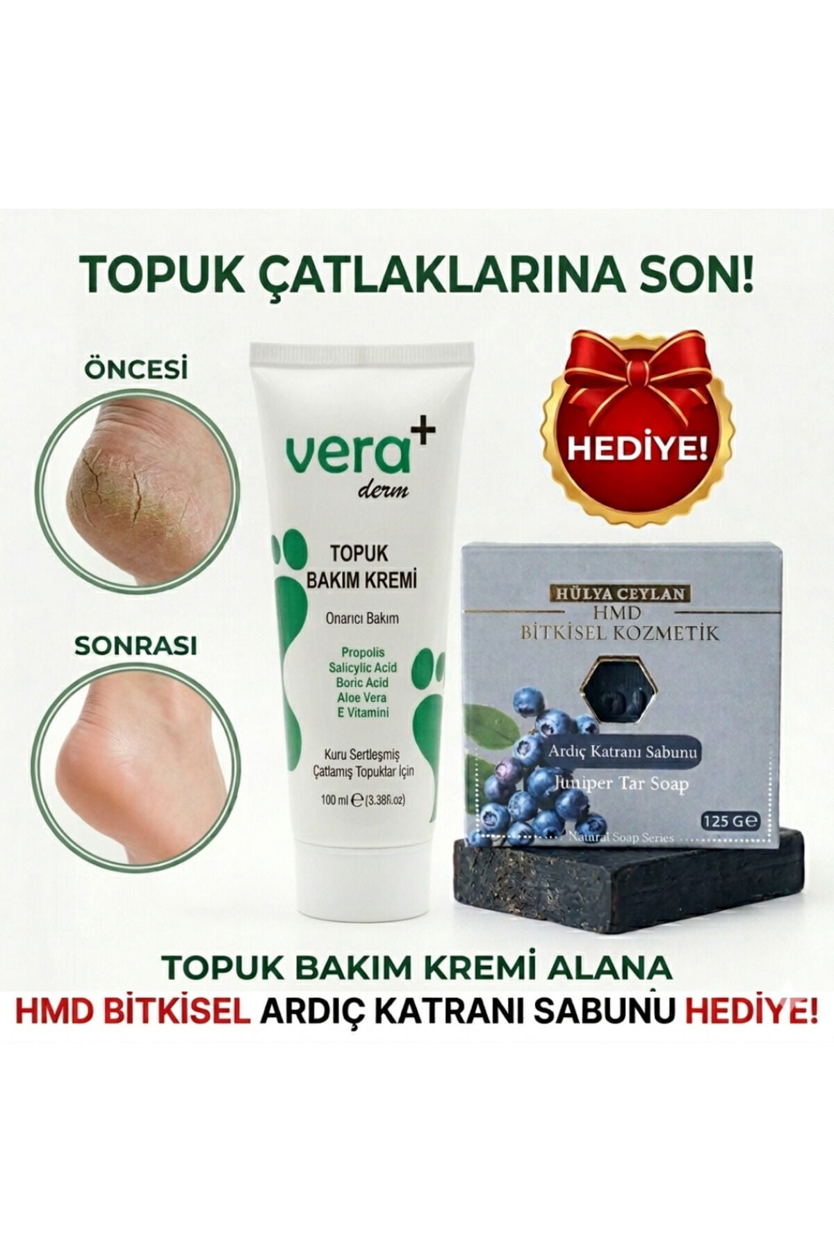 Ayak ve Topuk Çatlak Kremi 100 ml | Yoğun Nemlendirici, Onarıcı ve Koku Önleyici Profesyonel Bakım Kremi